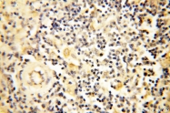 14021-1-AP - NCEH1 / AADACL1