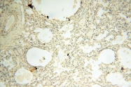 14021-1-AP - NCEH1 / AADACL1