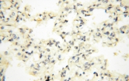 14021-1-AP - NCEH1 / AADACL1