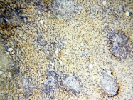 14021-1-AP - NCEH1 / AADACL1