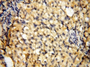 14021-1-AP - NCEH1 / AADACL1