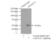 14021-1-AP - NCEH1 / AADACL1
