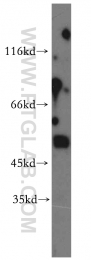 14021-1-AP - NCEH1 / AADACL1