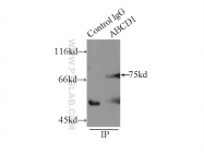 11159-1-AP - ABCD1 / ALDP