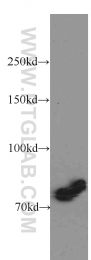 11159-1-AP - ABCD1 / ALDP
