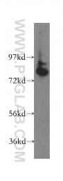 11159-1-AP - ABCD1 / ALDP