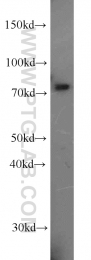 18138-1-AP - ABCD1 / ALDP