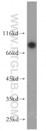 18138-1-AP - ABCD1 / ALDP