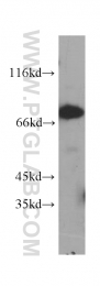 60153-1-Ig - ABCD1 / ALDP