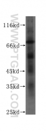 60153-1-Ig - ABCD1 / ALDP