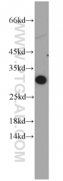 19419-1-AP - ABHD14A