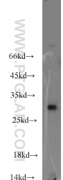 19419-1-AP - ABHD14A