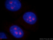 20952-1-AP - ABHD14B