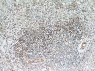 20952-1-AP - ABHD14B