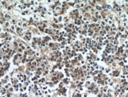 20952-1-AP - ABHD14B
