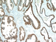 20952-1-AP - ABHD14B