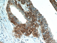 20952-1-AP - ABHD14B