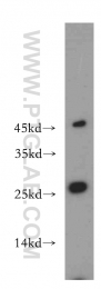 20952-1-AP - ABHD14B