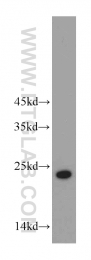 20952-1-AP - ABHD14B