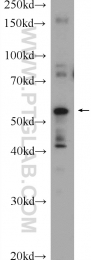 22526-1-AP - ABHD15