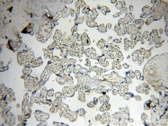 14039-1-AP - ABHD2 / LABH2