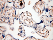 14039-1-AP - ABHD2 / LABH2