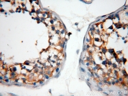 14039-1-AP - ABHD2 / LABH2