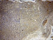 14039-1-AP - ABHD2 / LABH2