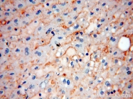 14039-1-AP - ABHD2 / LABH2