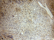 14039-1-AP - ABHD2 / LABH2