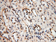 14039-1-AP - ABHD2 / LABH2