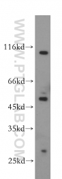 14039-1-AP - ABHD2 / LABH2