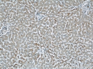 12201-1-AP - ABHD5