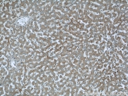 12201-1-AP - ABHD5