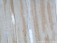 12201-1-AP - ABHD5