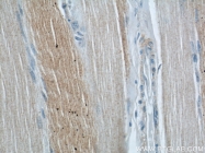 12201-1-AP - ABHD5