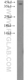 12201-1-AP - ABHD5