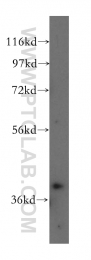 12201-1-AP - ABHD5