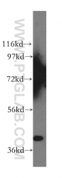 12201-1-AP - ABHD5