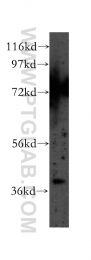 12201-1-AP - ABHD5
