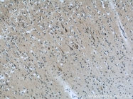 14890-1-AP - ABI2