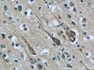 14890-1-AP - ABI2