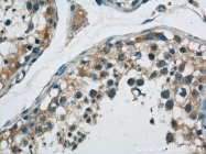 14890-1-AP - ABI2