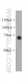 14890-1-AP - ABI2