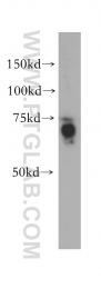 14890-1-AP - ABI2