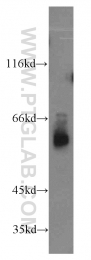 14890-1-AP - ABI2