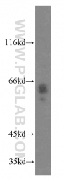 14890-1-AP - ABI2