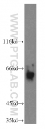 14890-1-AP - ABI2