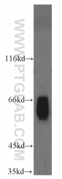 14890-1-AP - ABI2