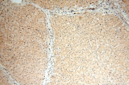 15129-1-AP - ABLIM1